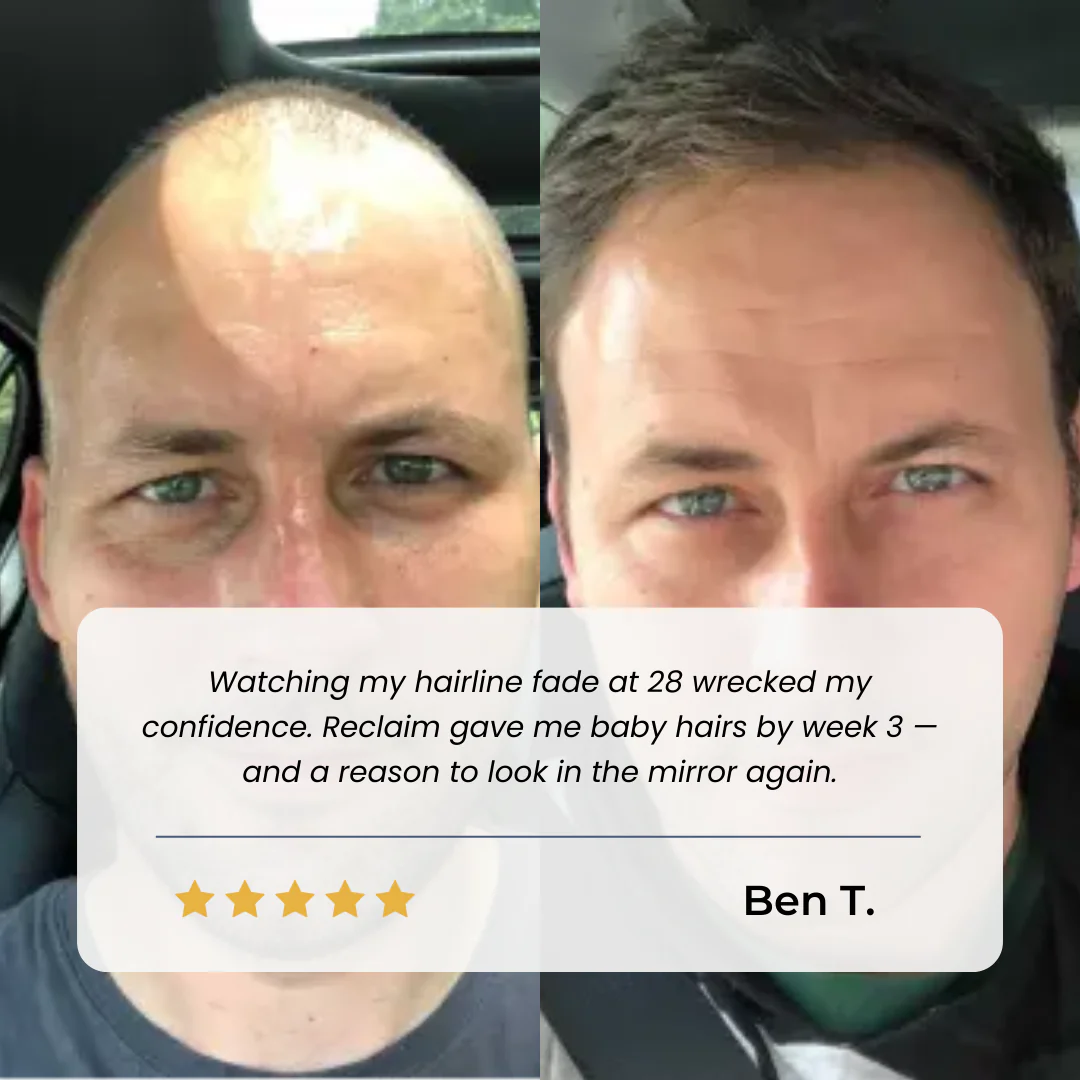 Hairline Recovery Serum by Yuriga