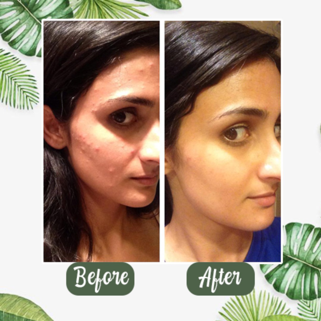 Yuriga™ Green Tea Deep Cleanse Mask Stick