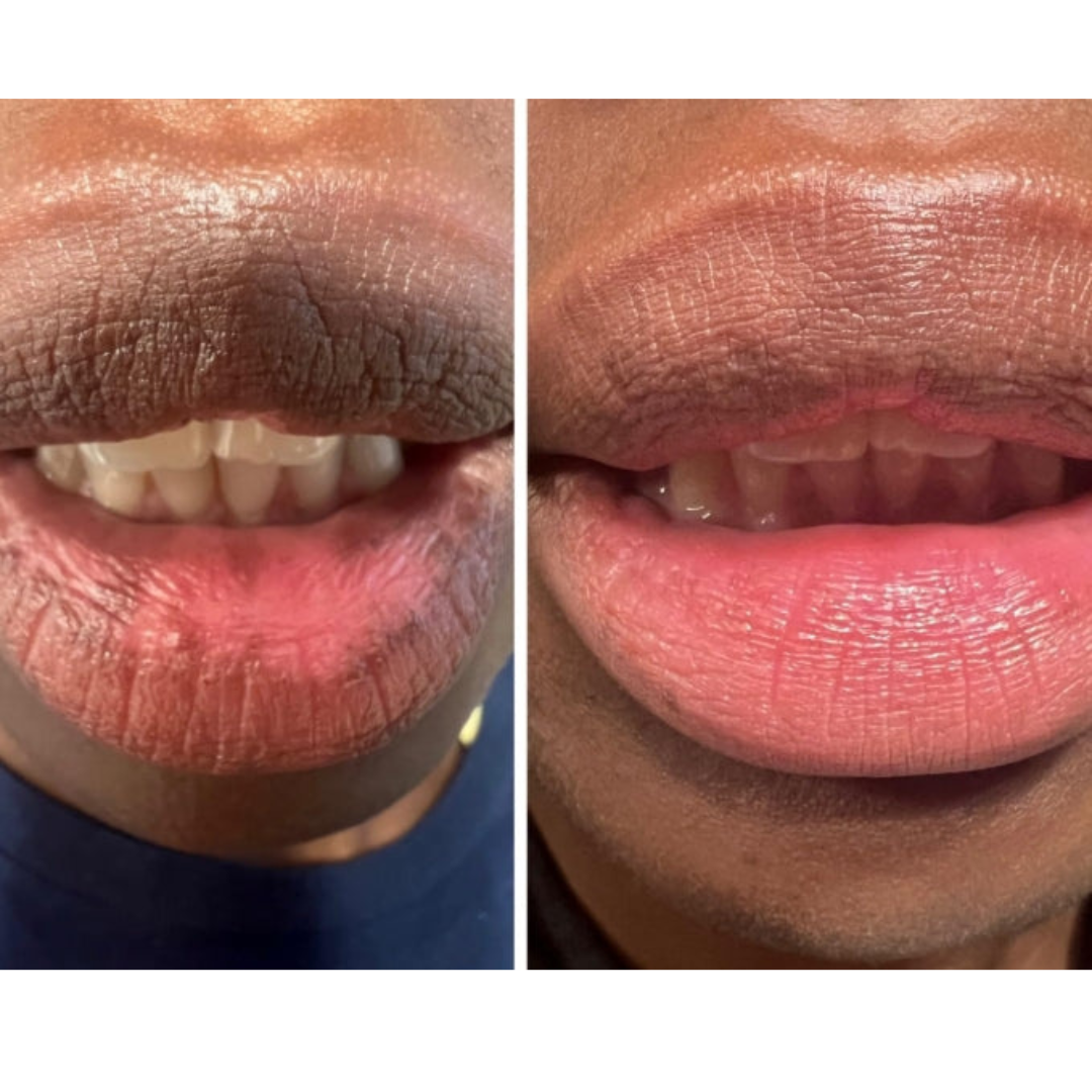 Yuriga™ Dark lips Cream