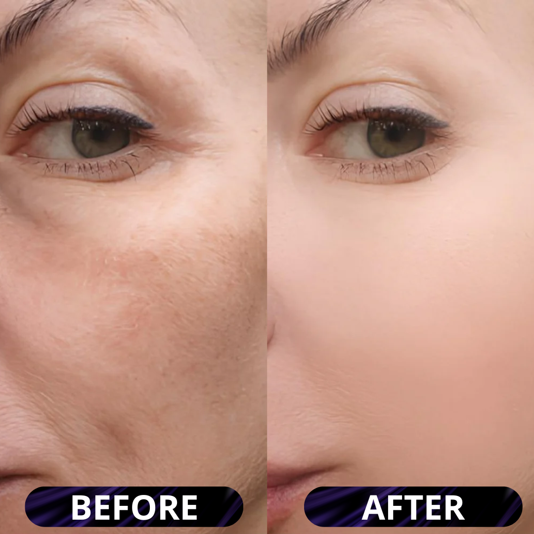 Rice Peel Serum Ampoule by Yuriga