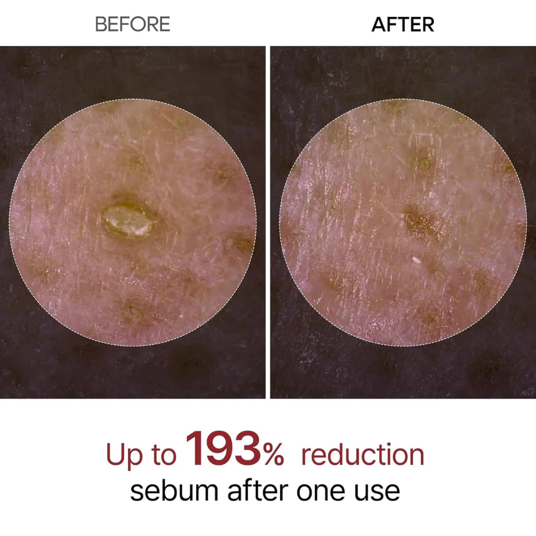 Rice Peel Serum Ampoule by Yuriga