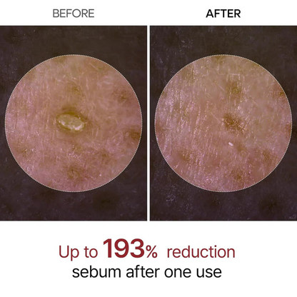 Rice Peel Serum Ampoule by Yuriga