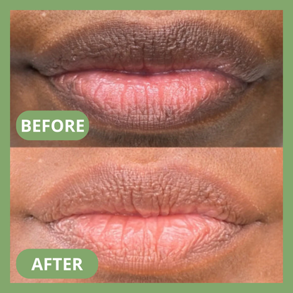 Yuriga™ Dark lips Cream
