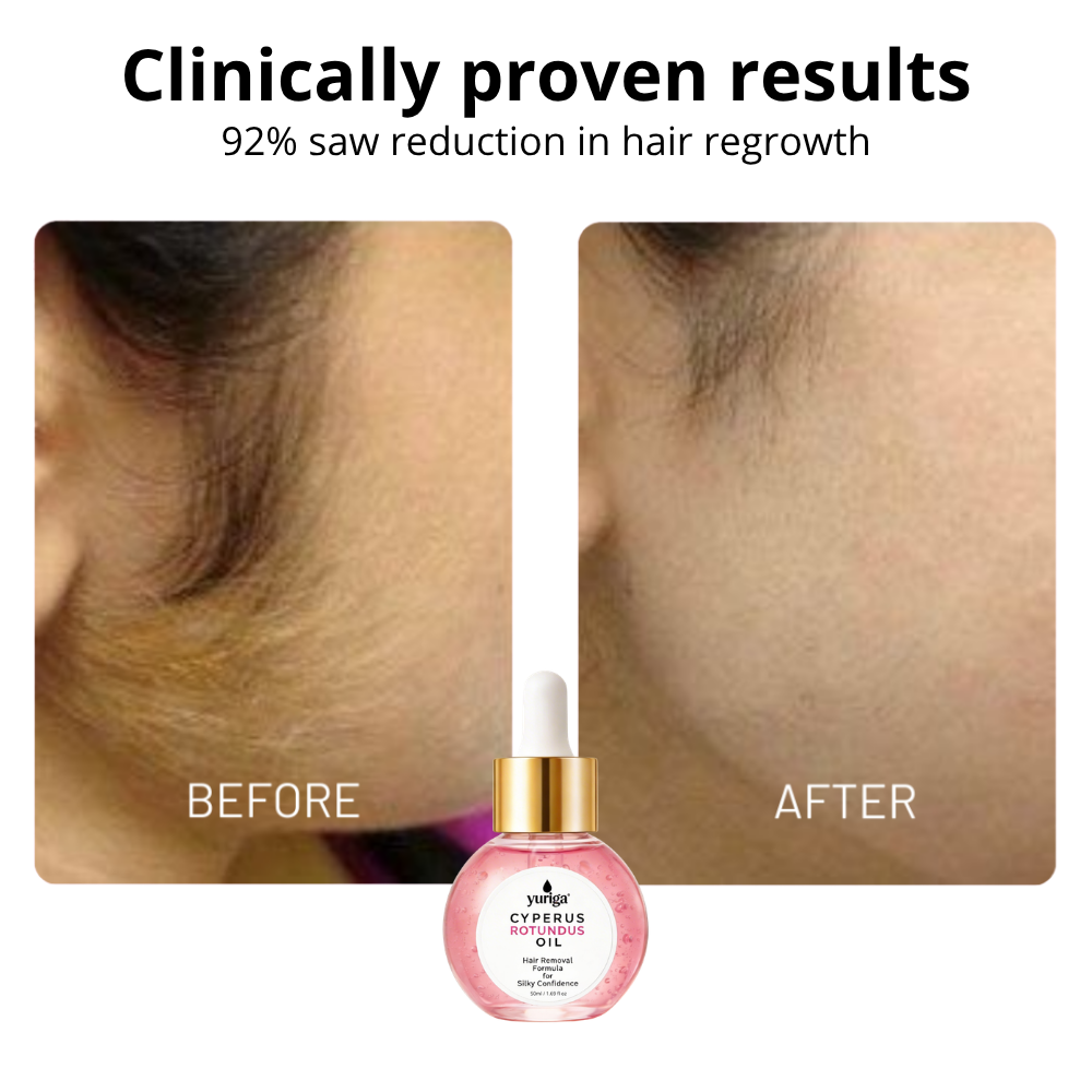 Cyperus Rotundus Oil - New Hair Removal Formula