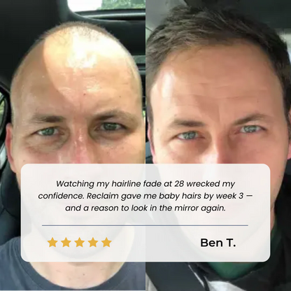 Hairline Recovery Serum by Yuriga