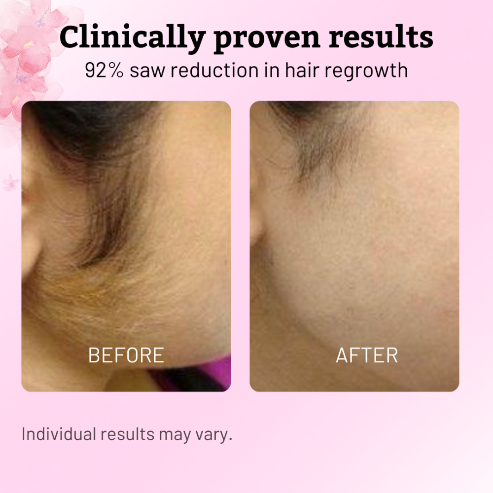 Cyperus Rotundus Oil | Hair Removal Formula