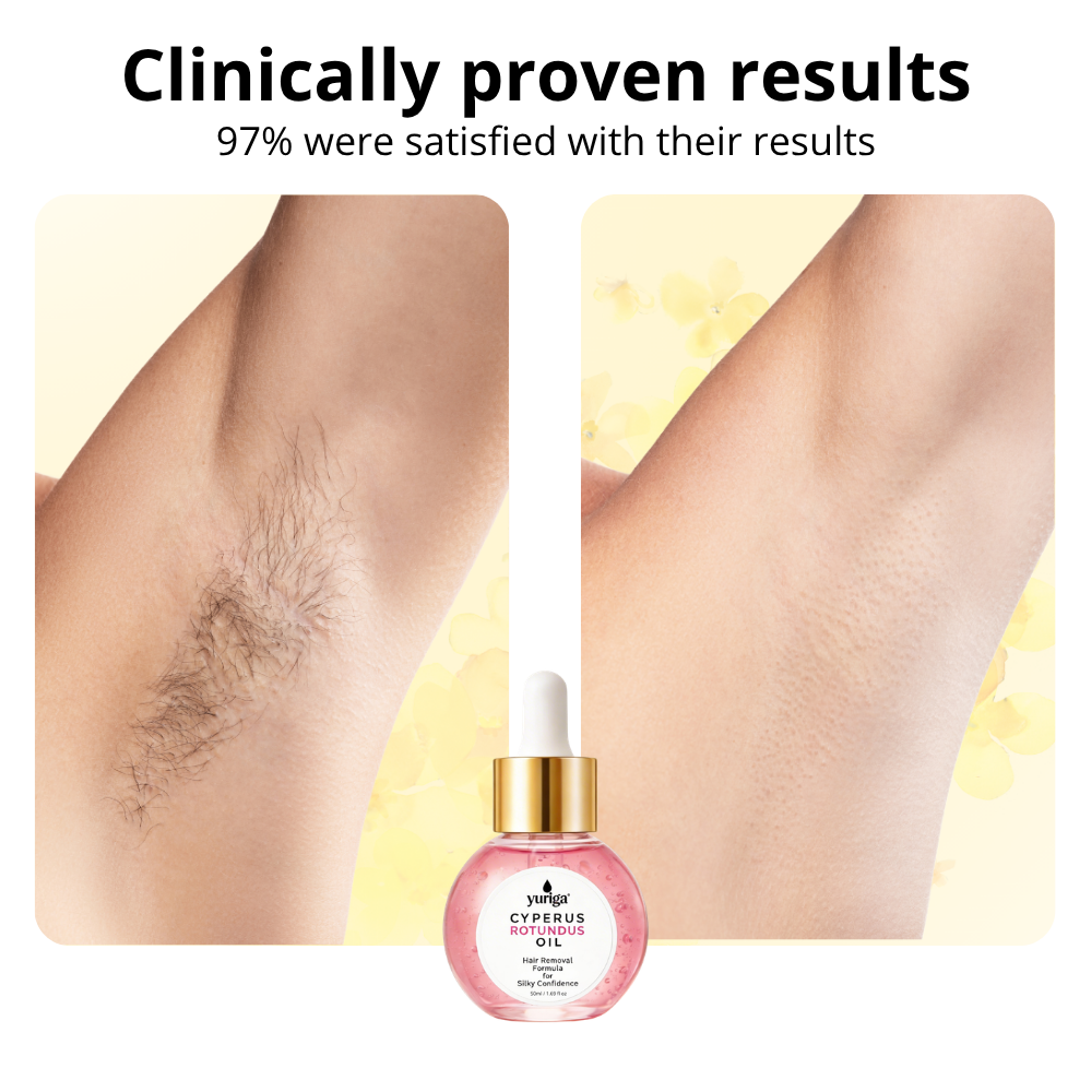 Cyperus Rotundus Oil - New Hair Removal Formula