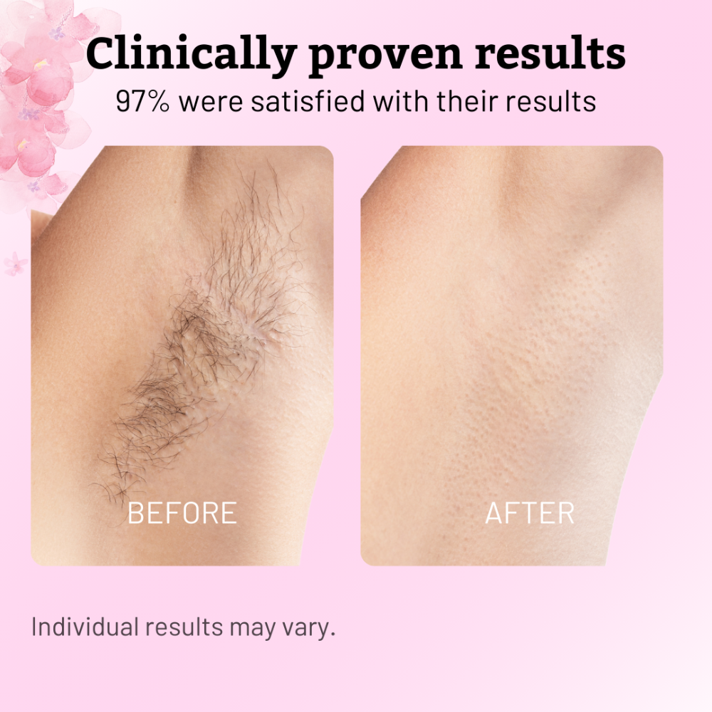 Cyperus Rotundus Oil | Hair Removal Formula