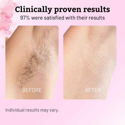 Cyperus Rotundus Oil | Hair Removal Formula