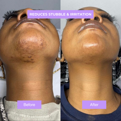 Yuriga Cyperus Rotundus Skin Serum