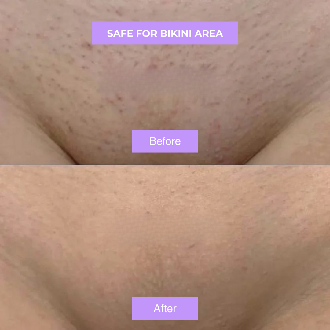 Yuriga Cyperus Rotundus Skin Serum