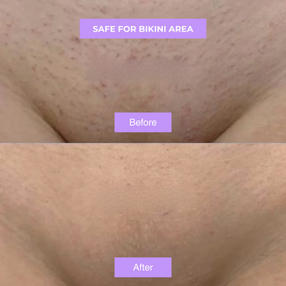 Yuriga Cyperus Rotundus Skin Serum