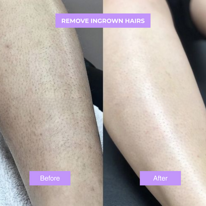 Yuriga Cyperus Rotundus Skin Serum