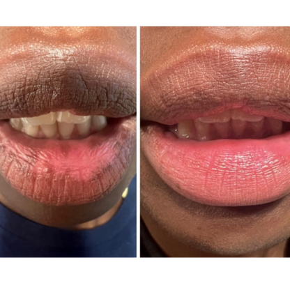 Yuriga™ Dark lips Cream