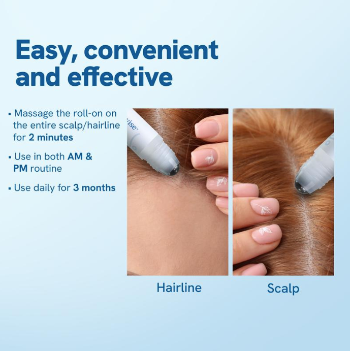 Hairline Recovery Serum by Yuriga